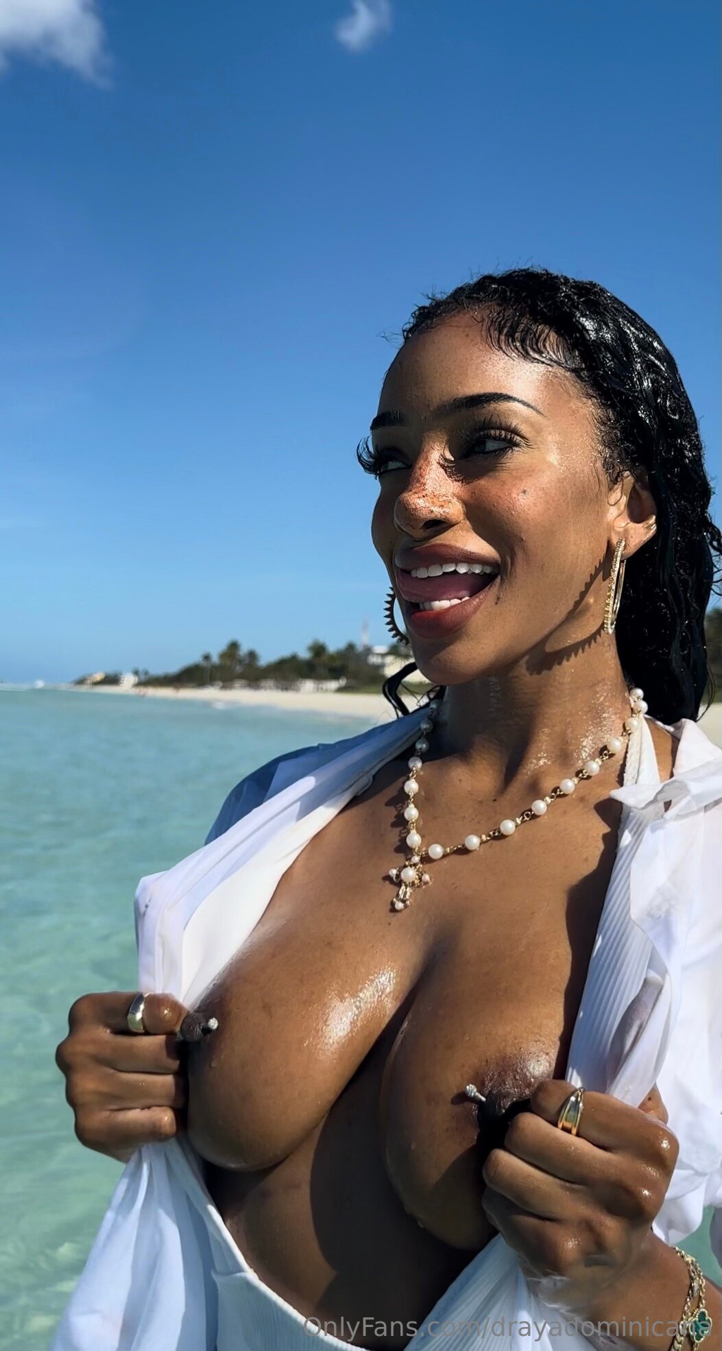 Image 4057011 from drayadominicana / Freckles