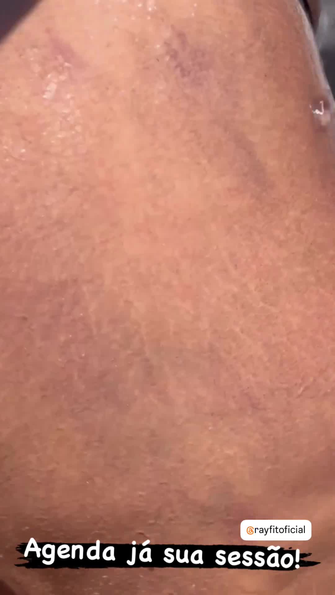 Video 207167 from Rayfit