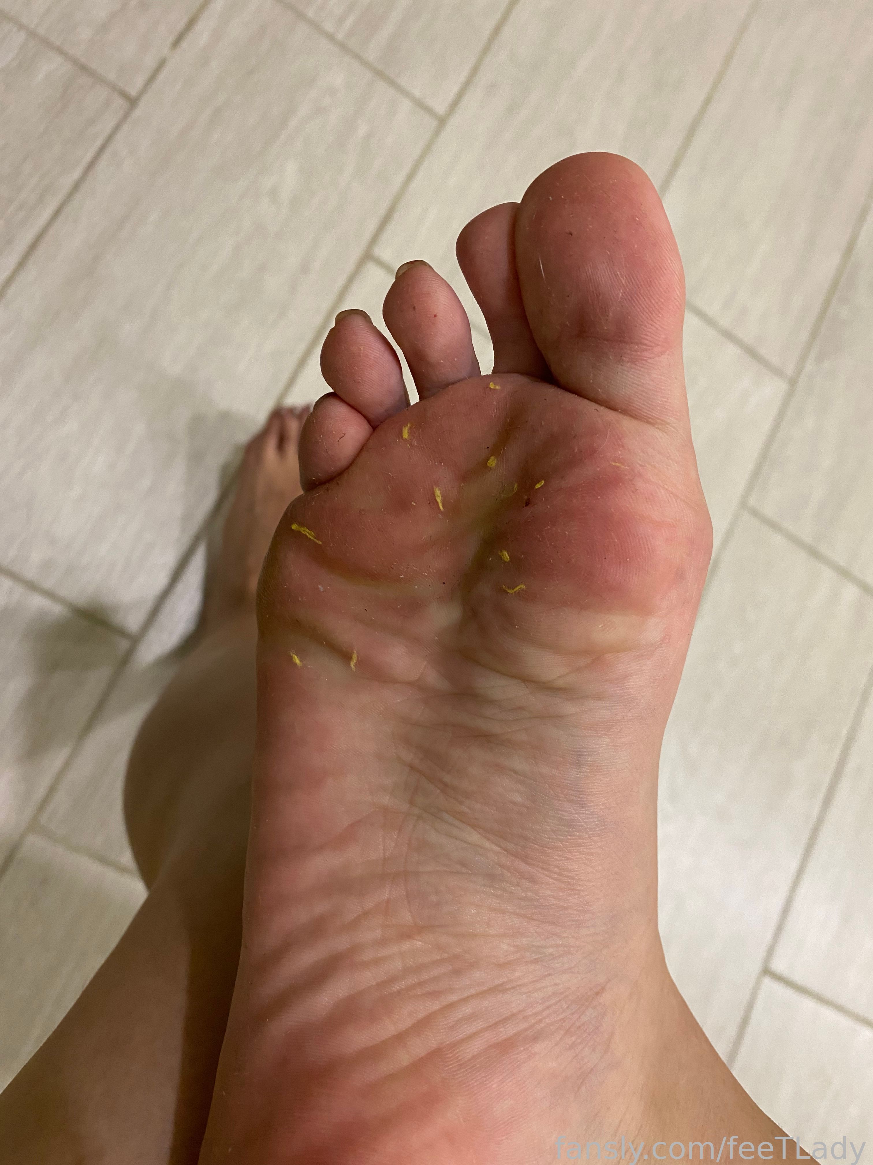 Image 9499099 from feeTLady